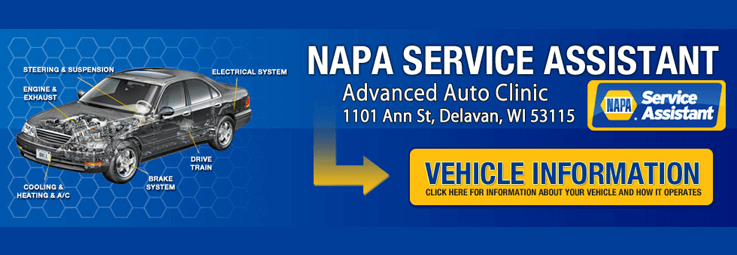 NAPA Know How: What is an ABS Sensor? — Advanced Auto Clinic in Delavan, WI